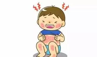 得了湿疹可以吃瓜吗,瓜类食物的适宜与禁忌