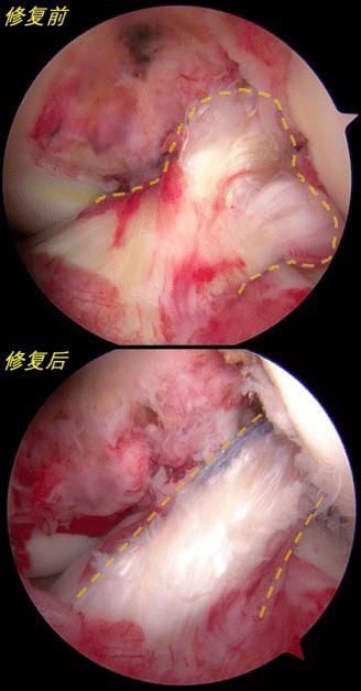哪明星断过韧带,足球巨星韧带断裂重生之路