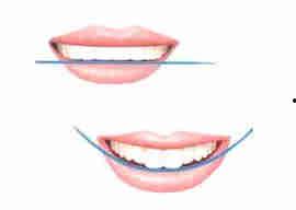 明星牙齿笑线,牙齿笑线背后的秘密